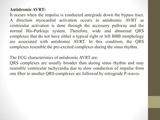 Antidromic AVRT:
It occurs when the impulse is conducted antegrade down the bypass tract.
A direction myocardial activation occurs in antidromic AVRT as
ventricular activation is done through the accessory pathway and the
normal His-Purkinje system. Therefore, wide and abnormal QRS
complexes that do not have either a typical right or left BBB morphology
are associated with antidromic AVRT. In this condition, the QRS
complexes resemble the pre-excited complexes during the sinus rhythm.
The ECG characteristics of antidromic AVRT are:
QRS complexes are usually broader than during sinus rhythm and may
resemble ventricular tachycardia due to slow conduction of impulse from
one fiber to another QRS complexes are followed by retrograde P-waves.
 