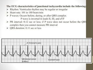 The ECG characteristics of junctional tachycardia include the following:
 Rhythm: Ventricular rhythm may be regular or irregular
 Heart rate: 101 to 180 beats/min
 P waves: Occurs before, during, or after QRS complex
P wave is inverted in leads II, III, and aVF
 PR interval: 0.12 sec or less; if P wave does not occur before the QRS
complex then you cannot measure PR interval
 QRS duration: 0.11 sec or less
 