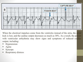 When the electrical impulses come from the ventricles instead of the atria, the atrial
kick is lost, and the cardiac output decreases as much as 30%. As a result, the patient
with ventricular arrhythmia may show signs and symptoms of reduced cardiac
output, including:
 Hypotension
 Agina
 Syncope
 Respiratory distress
 
