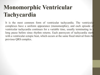 Monomorphic Ventricular
Tachycardia
It is the most common form of ventricular tachycardia. The ventricular
complexes have a uniform appearance (monomorphic), and each episode of
ventricular tachycardia continues for a variable time, usually terminating in a
long pause before sinus rhythm returns. Each paroxysm of tachycardia starts
with a ventricular ectopic beat, which occurs at the same fixed interval from the
previous QRS complex.
 