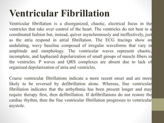 Ventricular Fibrillation
Ventricular fibrillation is a disorganized, chaotic, electrical focus in the
ventricles that take over control of the heart. The ventricles do not beat in a
coordinated fashion but, instead, quiver asynchronously and ineffectively, just
as the atria respond in atrial fibrillation. The ECG tracings show an
undulating, wavy baseline composed of irregular waveforms that vary in
amplitude and morphology. The ventricular waves represent chaotic,
incomplete, and haphazard depolarization of small groups of muscle fibers in
the ventricles. P waves and QRS complexes are absent due to lack of
organized depolarization of atria and ventricles.
Coarse ventricular fibrillations indicate a more recent onset and are more
likely to be reversed by defibrillation alone. Whereas, fine ventricular
fibrillation indicates that the arrhythmia has been present longer and may
require therapy first, then defibrillation. If defibrillations do not restore the
cardiac rhythm, then the fine ventricular fibrillation progresses to ventricular
asystole.
 