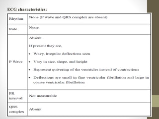 ECG characteristics:
 
