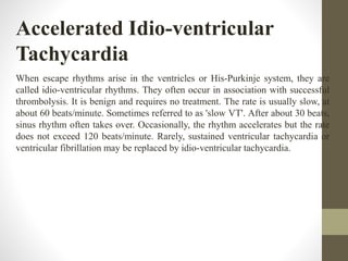 Accelerated Idio-ventricular
Tachycardia
When escape rhythms arise in the ventricles or His-Purkinje system, they are
called idio-ventricular rhythms. They often occur in association with successful
thrombolysis. It is benign and requires no treatment. The rate is usually slow, at
about 60 beats/minute. Sometimes referred to as 'slow VT'. After about 30 beats,
sinus rhythm often takes over. Occasionally, the rhythm accelerates but the rate
does not exceed 120 beats/minute. Rarely, sustained ventricular tachycardia or
ventricular fibrillation may be replaced by idio-ventricular tachycardia.
 