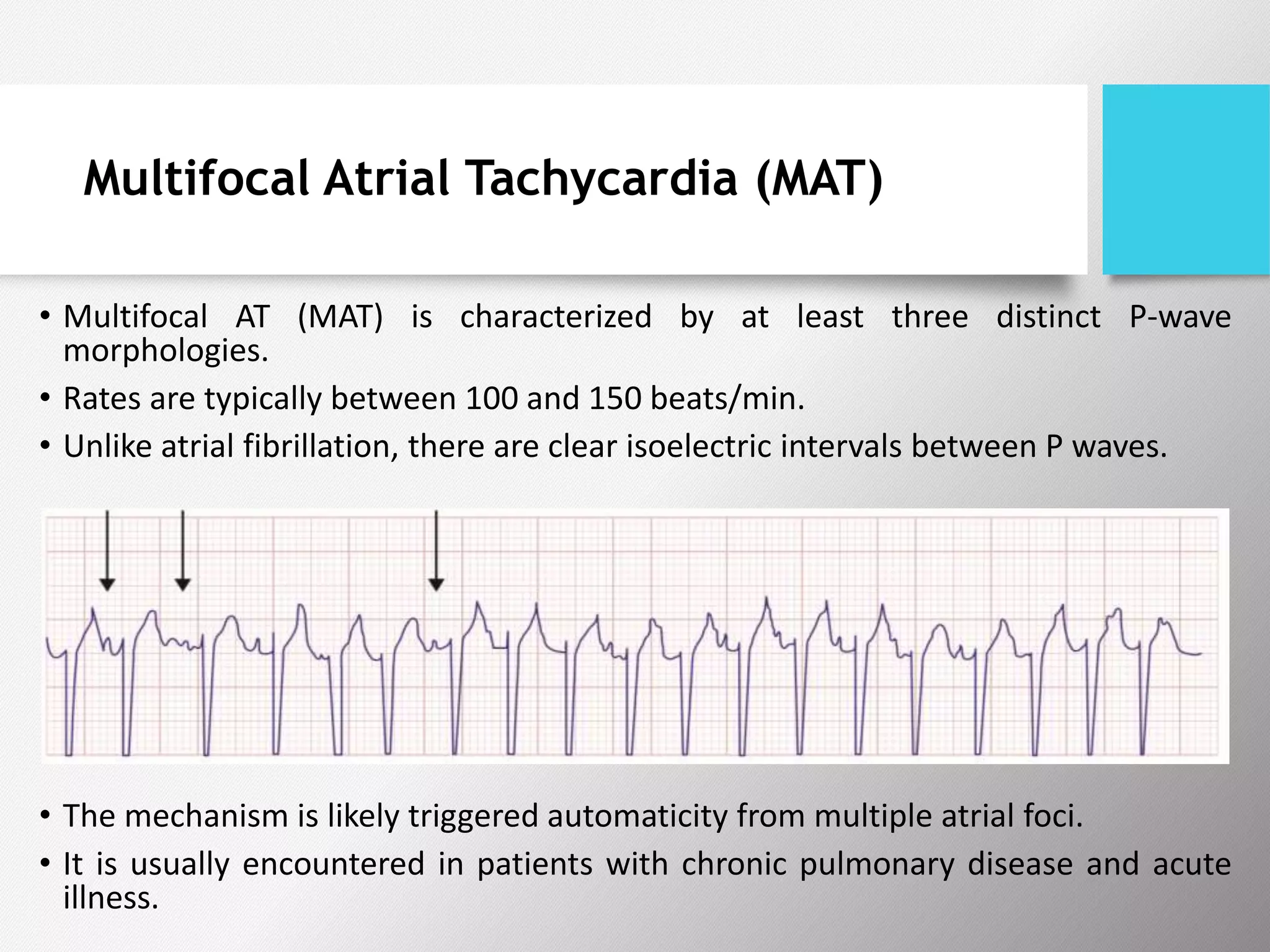 Multifocal Atrial Tachycardia (MAT)
• Multifocal AT (MAT) is characterized by at least three distinct P-wave
morphologies.
• Rates are typically between 100 and 150 beats/min.
• Unlike atrial fibrillation, there are clear isoelectric intervals between P waves.
• The mechanism is likely triggered automaticity from multiple atrial foci.
• It is usually encountered in patients with chronic pulmonary disease and acute
illness.
 