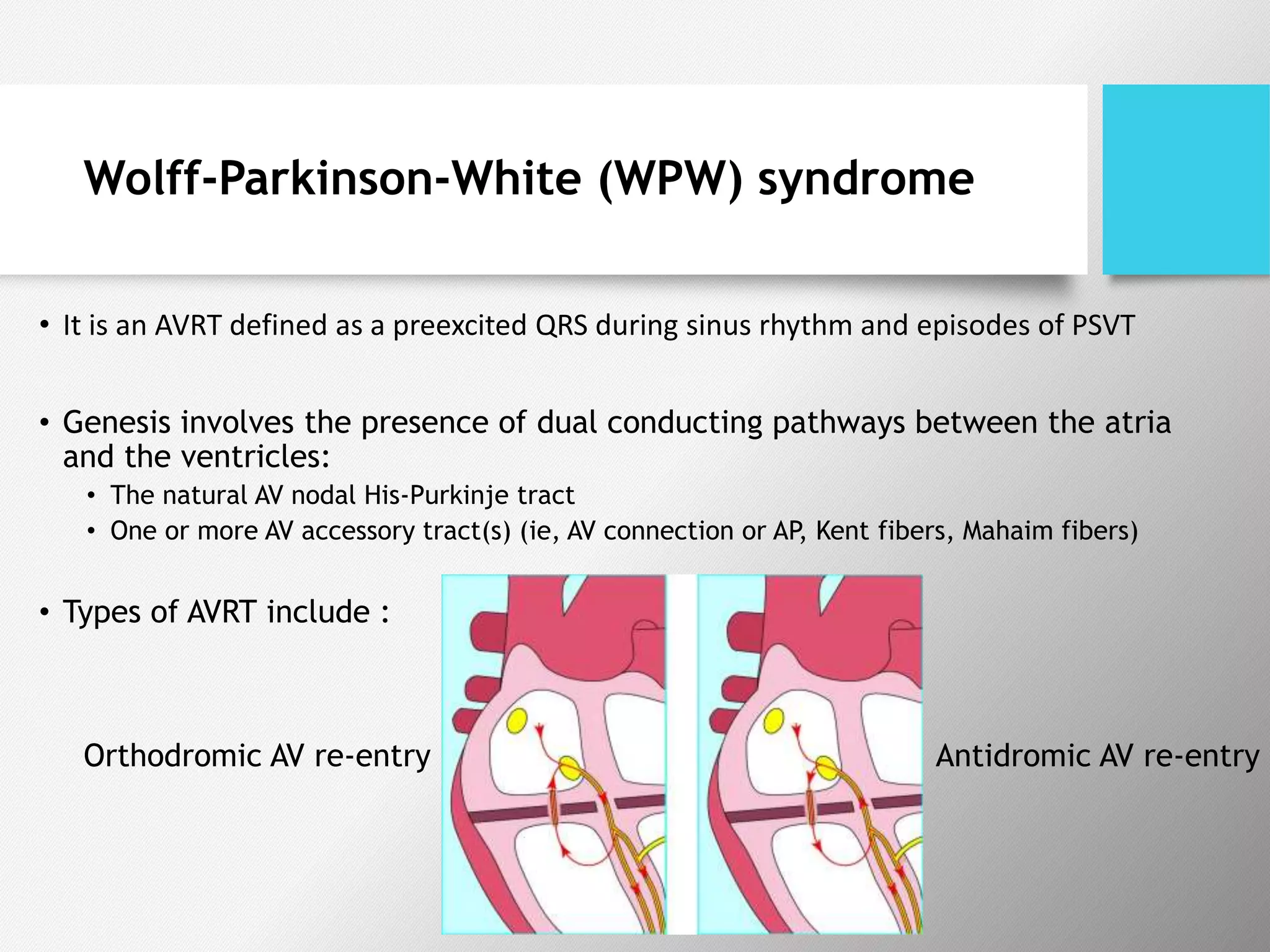 Wolff-Parkinson-White (WPW) syndrome
• It is an AVRT defined as a preexcited QRS during sinus rhythm and episodes of PSVT
• Genesis involves the presence of dual conducting pathways between the atria
and the ventricles:
• The natural AV nodal His-Purkinje tract
• One or more AV accessory tract(s) (ie, AV connection or AP, Kent fibers, Mahaim fibers)
• Types of AVRT include :
Antidromic AV re-entryOrthodromic AV re-entry
 