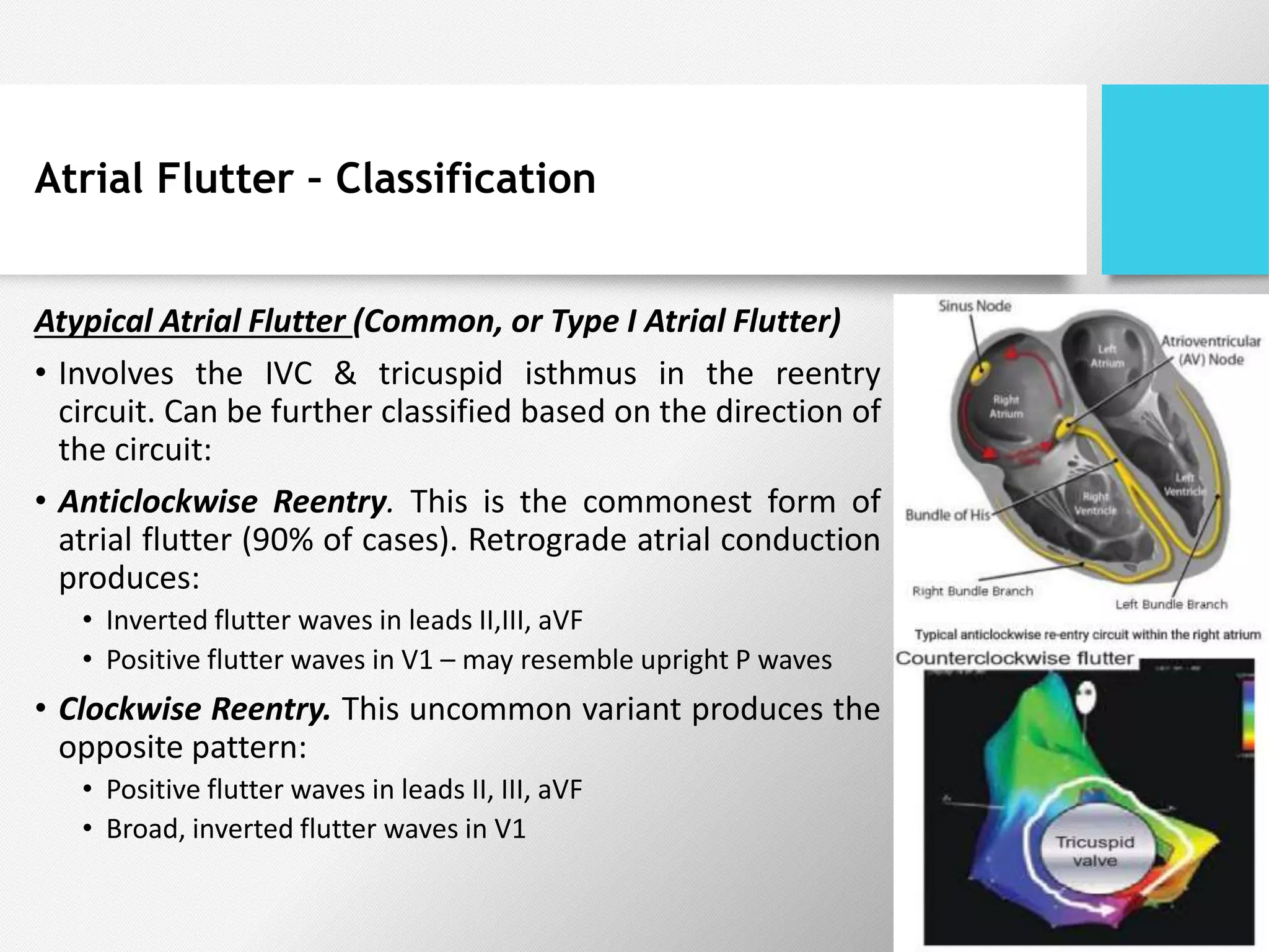 Atrial Flutter – Classification
Atypical Atrial Flutter (Common, or Type I Atrial Flutter)
• Involves the IVC & tricuspid isthmus in the reentry
circuit. Can be further classified based on the direction of
the circuit:
• Anticlockwise Reentry. This is the commonest form of
atrial flutter (90% of cases). Retrograde atrial conduction
produces:
• Inverted flutter waves in leads II,III, aVF
• Positive flutter waves in V1 – may resemble upright P waves
• Clockwise Reentry. This uncommon variant produces the
opposite pattern:
• Positive flutter waves in leads II, III, aVF
• Broad, inverted flutter waves in V1
 