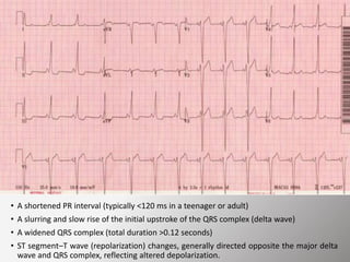Short Pri Tachy Arrhythmias - Approach to Management | PPTX