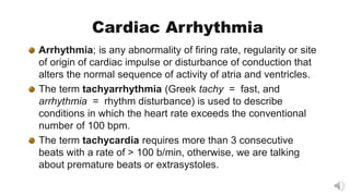 Tachy Fast Drawing Tachyarrhythmias 2020 (for the undergraduates) | PPT