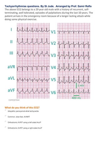 Tachyarrhythmias questions. By St Jude. Arranged by Prof. Samir Rafla
The above ECG belongs to a 29 year old male with a history of recurrent, self-
terminating, well tolerated, episodes of palpitations during the last 10 years. The
patient arrives in the emergency room because of a longer lasting attack while
doing some physical exercise.
What do you think of this ECG?
Idiopathic paroxysmal atrial tachycardia
Common, slow-fast, AVNRT
Orthodromic AVRT using a left sided AccP
Orthodromic AVRT using a right sided AccP
 