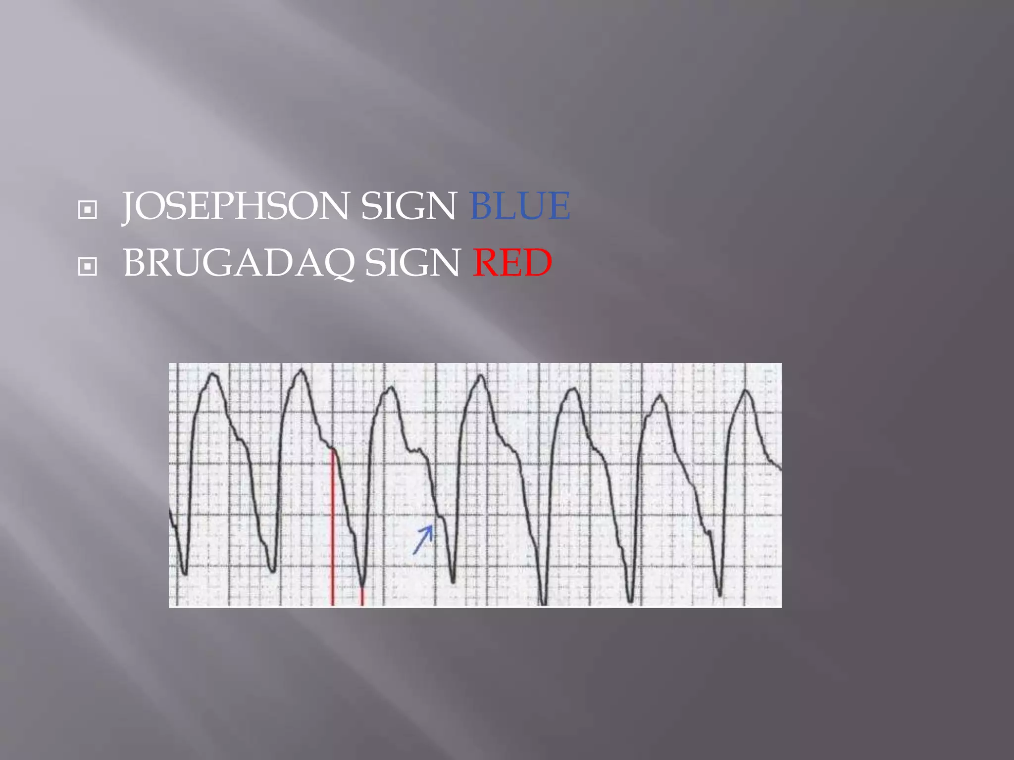  JOSEPHSON SIGN BLUE
 BRUGADAQ SIGN RED
 