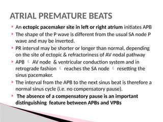 Pathway Apb Tachyarrythmias in the perioperative period.pptx
