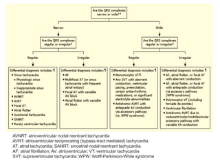 TACHYCARDIA IN ECG ,CAUSES AND MANAGEMENT OF TACHYARRHYTHMIAS | PPTX