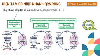 Tiếp cận ban đầu rối loạn nhịp tim nhanh | PDF