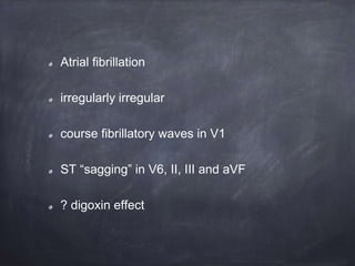 Atrial fibrillation
irregularly irregular
course fibrillatory waves in V1
ST “sagging” in V6, II, III and aVF
? digoxin effect
 
