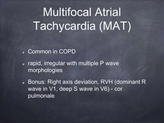 Common in COPD
rapid, irregular with multiple P wave
morphologies
Bonus: Right axis deviation, RVH (dominant R
wave in V1, deep S wave in V6) - cor
pulmonale
Multifocal Atrial
Tachycardia (MAT)
 