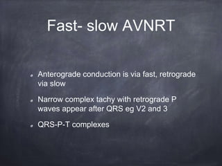 Anterograde conduction is via fast, retrograde
via slow
Narrow complex tachy with retrograde P
waves appear after QRS eg V2 and 3
QRS-P-T complexes
Fast- slow AVNRT
 