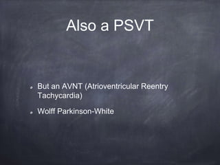 Also a PSVT
But an AVNT (Atrioventricular Reentry
Tachycardia)
Wolff Parkinson-White
 