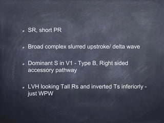 SR, short PR
Broad complex slurred upstroke/ delta wave
Dominant S in V1 - Type B, Right sided
accessory pathway
LVH looking Tall Rs and inverted Ts inferiorly -
just WPW
 