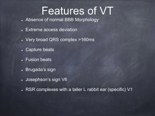 Absence of normal BBB Morphology
Extreme access deviation
Very broad QRS complex >160ms
Capture beats
Fusion beats
Brugada’s sign
Josephson’s sign V6
RSR complexes with a taller L rabbit ear (specific) V1
Features of VT
 