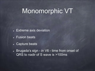 Extreme axis deviation
Fusion beats
Capture beats
Brugada’s sign - in V6 - time from onset of
QRS to nadir of S wave is >100ms
Monomorphic VT
 