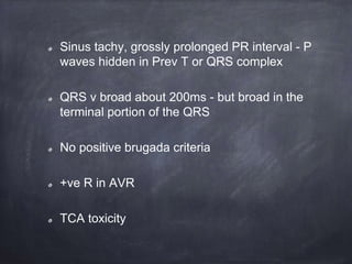 Sinus tachy, grossly prolonged PR interval - P
waves hidden in Prev T or QRS complex
QRS v broad about 200ms - but broad in the
terminal portion of the QRS
No positive brugada criteria
+ve R in AVR
TCA toxicity
 