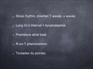 Sinus rhythm, inverted T waves, u waves
Long Q-U interval = hyopkalaemia
Premature atrial beat
R-on-T phenomenom
Torsades du pointes
 
