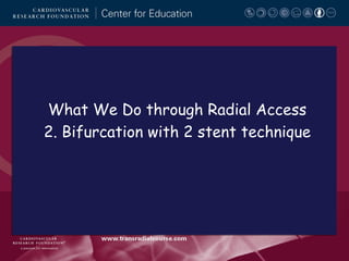 What We Do through Radial Access
2. Bifurcation with 2 stent technique

 