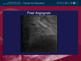 Final Angiogram

 