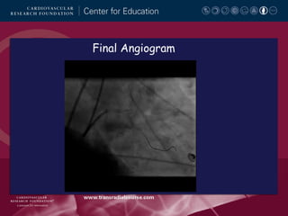 Final Angiogram

 