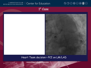 1° Case

Heart Team decision > PCI on LM/LAD

 
