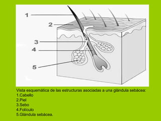 Vista esquemática de las estructuras asociadas a una glándula sebácea: 1.Cabello 2.Piel 3.Sebo 4.Folículo 5.Glándula sebácea. 