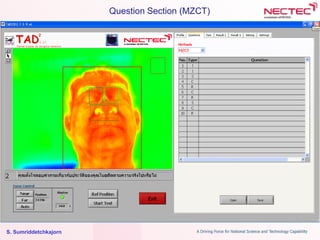 S. Sumriddetchkajorn
Question Section (MZCT)
 