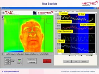 S. Sumriddetchkajorn
Test Section
Left Periorbital
Right Periorbital
Nostril
Envt.
Q Started Q Stop
Subject responses
 