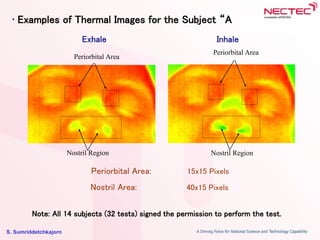 S. Sumriddetchkajorn
Nostril Region
Periorbital Area
Nostril Region
Periorbital Area
Exhale
• Examples of Thermal Images for the Subject “A
Inhale
Periorbital Area: 15x15 Pixels
Nostril Area: 40x15 Pixels
Note: All 14 subjects (32 tests) signed the permission to perform the test.
 