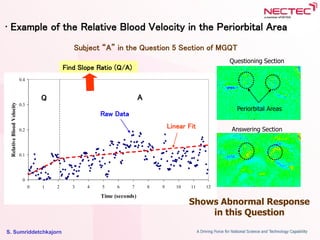 S. Sumriddetchkajorn
0
0.1
0.2
0.3
0.4
0 1 2 3 4 5 6 7 8 9 10 11 12
Time (seconds)
RelativeBloodVelocity
• Example of the Relative Blood Velocity in the Periorbital Area
Linear Fit
Raw Data
Q A
Find Slope Ratio (Q/A)
Shows Abnormal Response
in this Question
Periorbital Areas
Questioning Section
Answering Section
Subject “A” in the Question 5 Section of MGQT
 