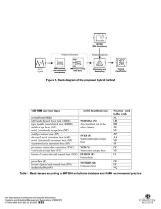 Figure 1. Block diagram of the proposed hybrid method
MIT-BIH heartbeat types AAMI heartbeat class Notation used
in this work
normal beat (NOR)
NORMAL (N)
Any heartbeat not in the
other classes
NL
left bundle branch bock beat (LBBB) LB
rignt bundle branch block beat (RBBB) RB
atrial escape beats (AE) AE
nodal (junctional) escape beat (NE) NE
atrial premature beat (AP)
SVEB (S)
Supraventricular ectopic
beat
AP
aberrated atrial premature beat (aAP) AA
nodal (junctional) premature beat (NP) NP
supraventricular premature beat (SP) SP
premature ventricular contraction (PVC) VEB (V)
Ventricular ectopic beat
PV
ventricular escape beat (VE) VE
fusion of ventricular and normal beat (fVN) FUSION (F)
Fusion beat
FS
paced beat (P)
NOTQRS (Q)
Unknown beat
PB
fusion of paced and normal beat (fPN) PF
unclassified beat (U) NQ
Table 1. Beat classes according to MIT/BIH arrhythmia database and AAMI recommended practice
6th International Conference on Computer Information
Systems and Industrial Management Applications (CISIM'07)
0-7695-2894-5/07 $20.00 © 2007
 