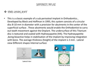 SUBPERIOSTEL IMPLANT
 THE ONPLANT
• This is a classic example of a sub periosteal implant in Orthodontics ,
Developed by Block and Hoffman in 1995, this system consists of a circular
disc 8-10 mm in diameter with a provision for abutments in the center of the
superficial surface . These abutments would enable the Orthodontist to carry
out tooth movement against the Onplant. The undersurface of this Titanium
disc is textured and coated with Hydroxyapatite (HA). The Hydroxyapetite
,being bioactive helps in stabilisation of the implant by improving integration
with bone. The average thickness (height) of the implant is 3 mm . Lateral
view Different shapes Internal surface
 