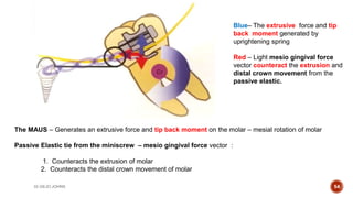 Mesial Rotation Bio-mechanics of TADS | PPTX