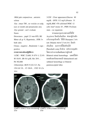 62

-Mild pale conjunctivae , anicteric        3.CSF : Clear appearance,Glucose 80
sclerae                                    mg/dL (DTX 112 mg%),Protein 31
-Ear ; intact TM , no vesicles at scalp,   mg/dL,RBC 470 cells/mm³,WBC 12
eyes or mouth and preauricular area        cells /mm³ (mono 45 , PMN 55),Gram
-Eye ground : can’t evaluate               stain – no organisms
Neuro                                              ทางแผนกกุมารเวชศาสตร์ได้ให้
Drowsiness , pupil 2.5 mm RTL BE           Acyclovir ฉี ดเข้าเส้นเลือด ต่อมาผู้ป่วยชัก
Motor all gr V, Hypertonia , DTR 3+        เกร็งกระตุกอีกครัง ได้ให้ Diazepam 2 มก.
                                                            ้
both sides                                 และ Dilantin ขนาด 7.5 มก./กก. ฉี ดเข้า
Clonus ; negative , Brudzinski ‘s sign :   เส้นเลือด   นอกจากนี้ได้เตรียมให้
positive                                   Phenobarb coma อีกด้วย หลังจากหยุดชัก
การตรวจทางห้องปฏิบัติการ                   ได้ตรวจร่างกายเพ่ิมเติมพบว่าผู้ป่วยมี
1.CBC : WBC 23,600, N 67% L 22.4%          Bilateral retinal hemorrhage     แพทย์ได้ทำา
M 10.6% ,Hb 8.6 g/dL Hct 26% ,             คอมพิวเตอร์สมองพบมี Subarachnoid and
Plt 502,000                                subdural hemorrhage at bilateral
2.Electrolyte :BUN 9.3,Cr 0.3 ,Na          parietooccipital lobes
138.1,K 5.8 , Cl 104.8 , CO2 18 ,Ca
10.4




ภาพท่ี 1: ภาพ CT Scan ของสมองผูู ภาพท่ี 2: ภาพ CT Scan ของสมองผูู
ป่ วย                            ปวย
 