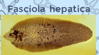 Fasciola hepatica
 