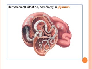 Human small intestine, commonly in jejunum
 