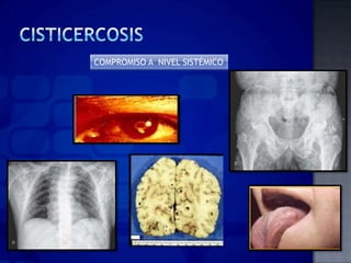 COMPROMISO A NIVEL SISTÉMICO
 