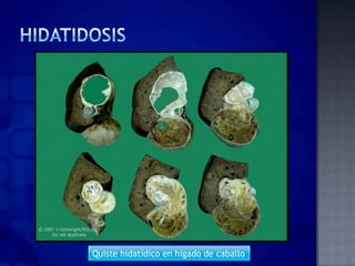 Quiste hidatídico en hígado de caballo
 