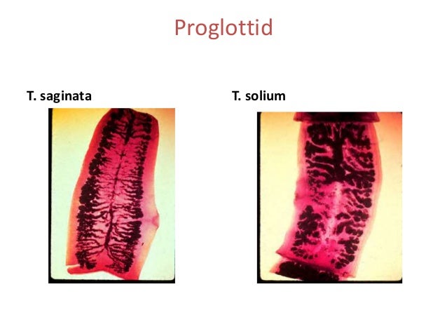 Taenia solium, saginata & neurocysticercosis