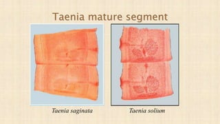 Taenia mature segment
Taenia soliumTaenia saginata
 