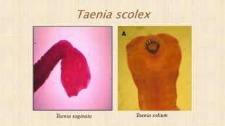 Taenia scolex
Taenia saginata Taenia solium
 