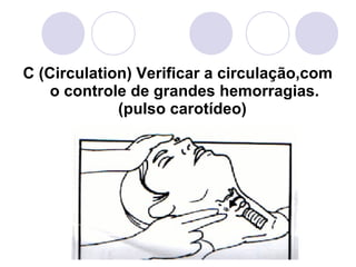 C (Circulation) Verificar a circulação,com
    o controle de grandes hemorragias.
             (pulso carotídeo)
 