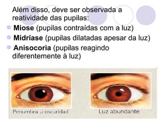 Além disso, deve ser observada a
 reatividade das pupilas:
Miose (pupilas contraídas com a luz)
Midríase (pupilas dilatadas apesar da luz)
Anisocoria (pupilas reagindo
 diferentemente à luz)
 