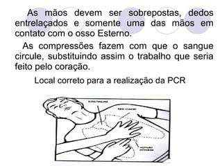 As mãos devem ser sobrepostas, dedos
entrelaçados e somente uma das mãos em
contato com o osso Esterno.
  As compressões fazem com que o sangue
circule, substituindo assim o trabalho que seria
feito pelo coração.
    Local correto para a realização da PCR
 