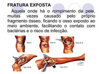 FRATURA EXPOSTA
  Aquela onde há o rompimento da pele,
muitas vezes causado pelo próprio
fragmento ósseo, ficando o osso exposto ao
meio ambiente, facilitando o contato com
bactérias e o risco de infecção.
 